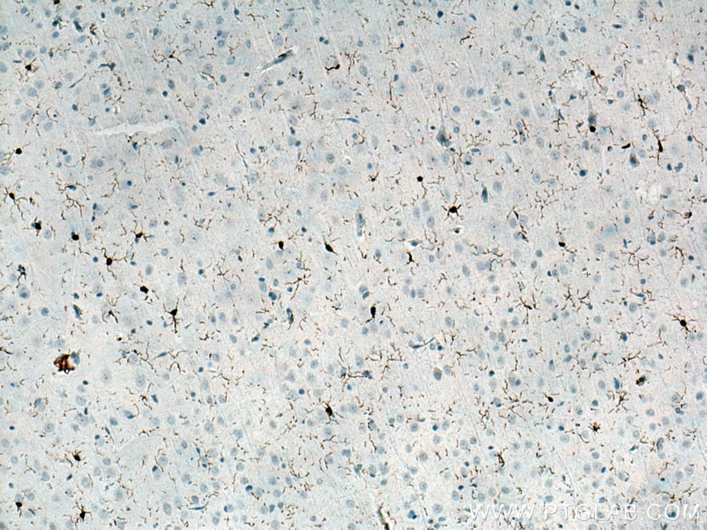 Immunohistochemistry (IHC) staining of rat brain tissue using IBA1 Polyclonal antibody (10904-1-AP)