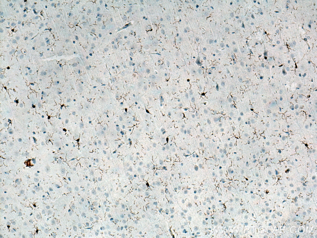 Immunohistochemistry (IHC) staining of rat brain tissue using IBA1 Polyclonal antibody (10904-1-AP)