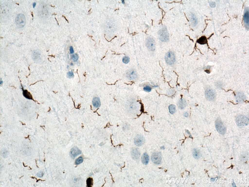 Immunohistochemistry (IHC) staining of rat brain tissue using IBA1 Polyclonal antibody (10904-1-AP)