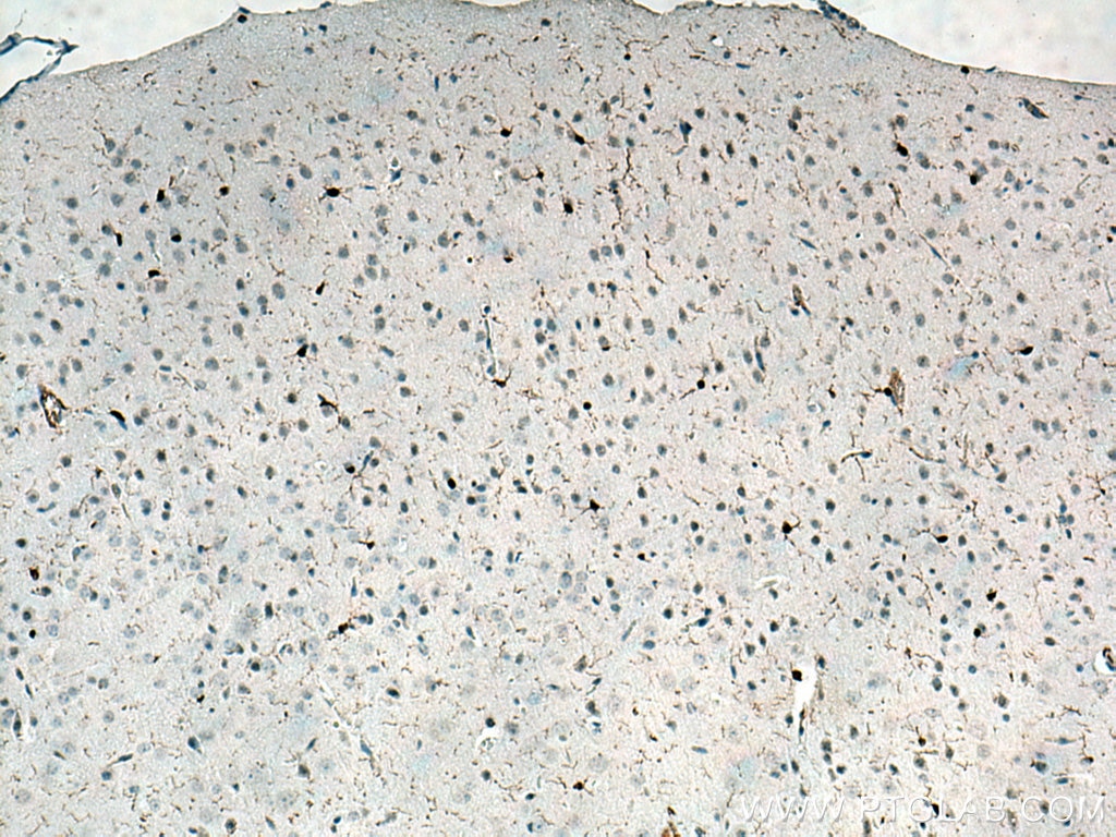 IHC staining of mouse brain using 10904-1-AP
