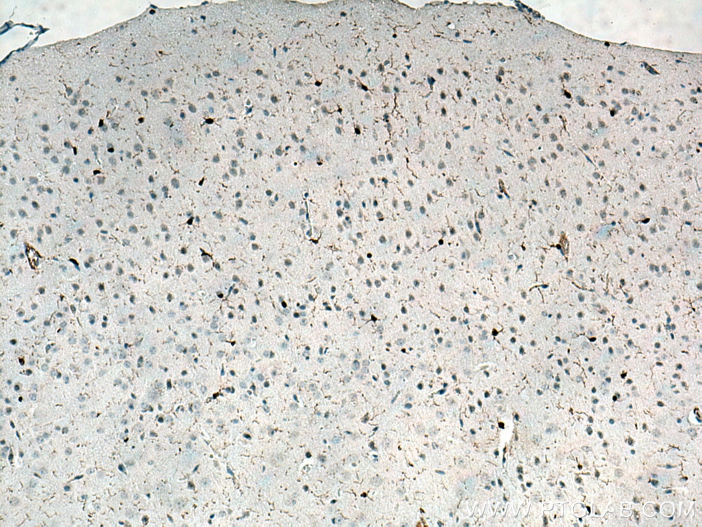 Immunohistochemistry (IHC) staining of mouse brain tissue using IBA1 Polyclonal antibody (10904-1-AP)