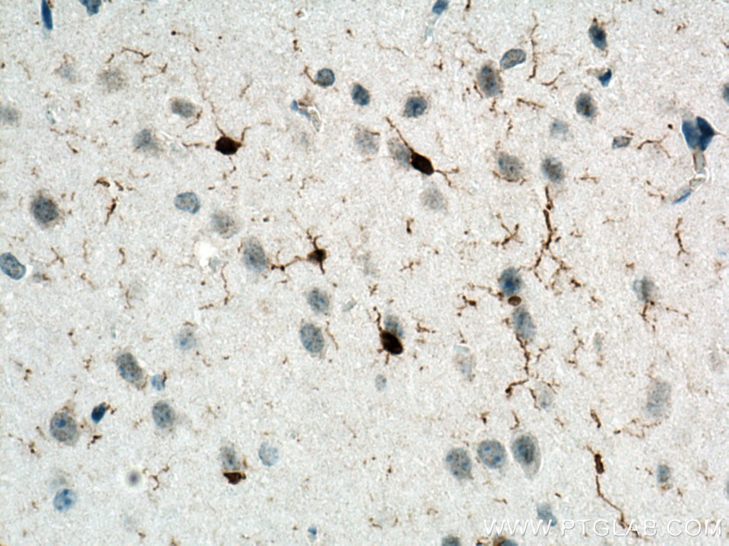 Immunohistochemistry (IHC) staining of mouse brain tissue using IBA1 Polyclonal antibody (10904-1-AP)
