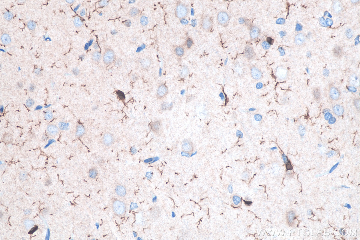 IHC staining of rat brain using 10904-1-AP Immunohistochemistry (IHC) staining of rat brain tissue using IBA1 Polyclonal antibody (10904-1-AP)
