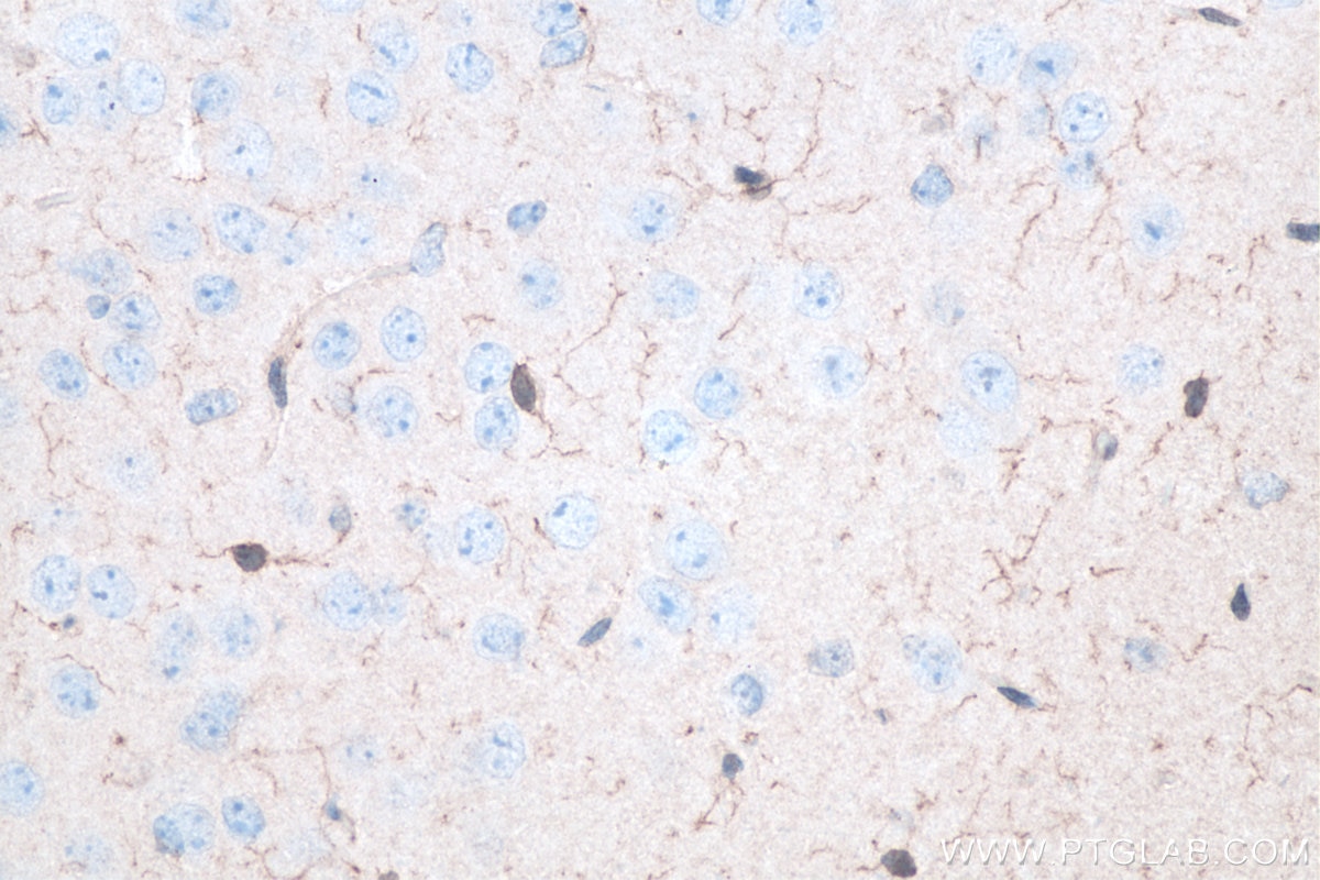 IHC staining of mouse brain using 10904-1-AP Immunohistochemistry (IHC) staining of mouse brain tissue using IBA1 Polyclonal antibody (10904-1-AP)
