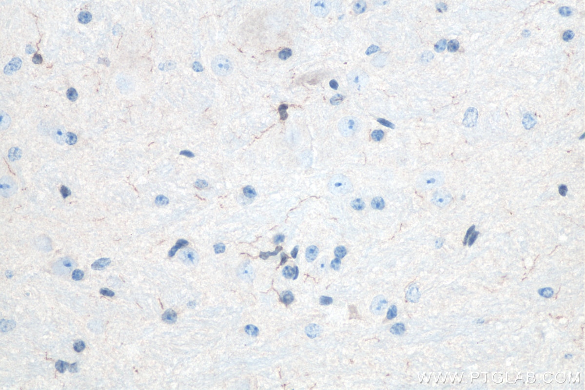IHC staining of mouse cerebellum using 10904-1-AP Immunohistochemistry (IHC) staining of mouse cerebellum tissue using IBA1 Polyclonal antibody (10904-1-AP)