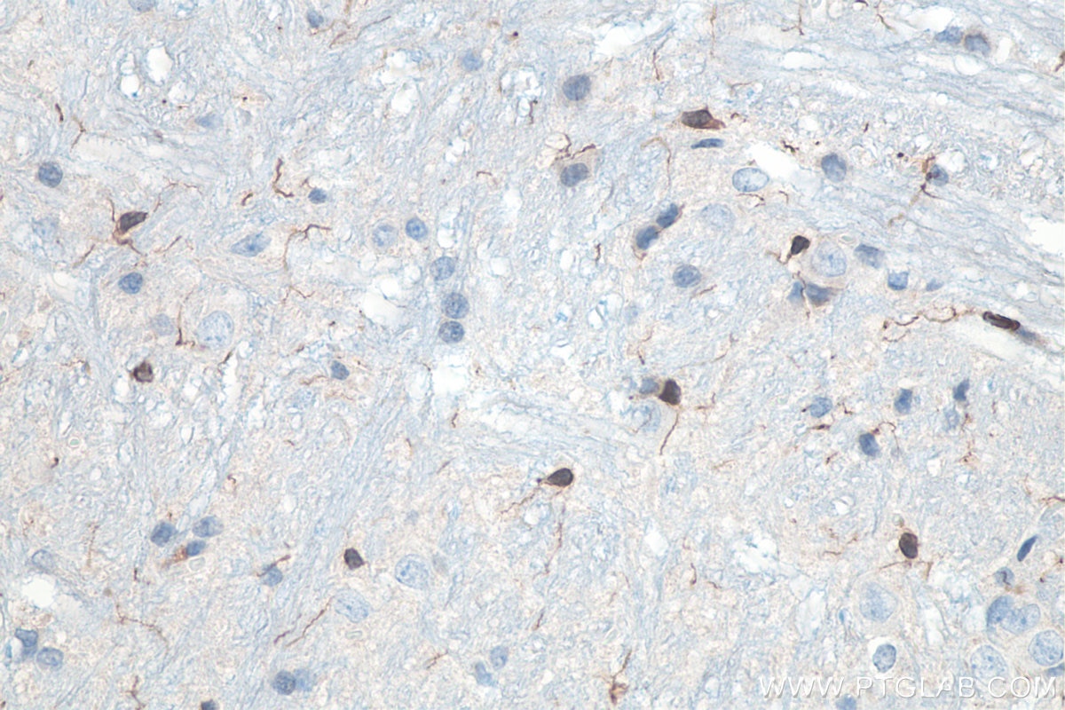 IHC staining of rat cerebellum using 10904-1-AP Immunohistochemistry (IHC) staining of rat cerebellum tissue using IBA1 Polyclonal antibody (10904-1-AP)