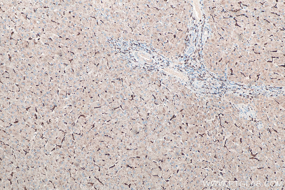 IHC staining of human liver using 10904-1-AP