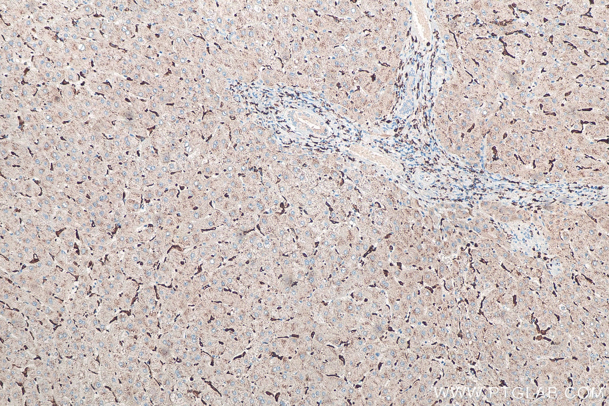 Immunohistochemistry (IHC) staining of human liver tissue using IBA1 Polyclonal antibody (10904-1-AP)