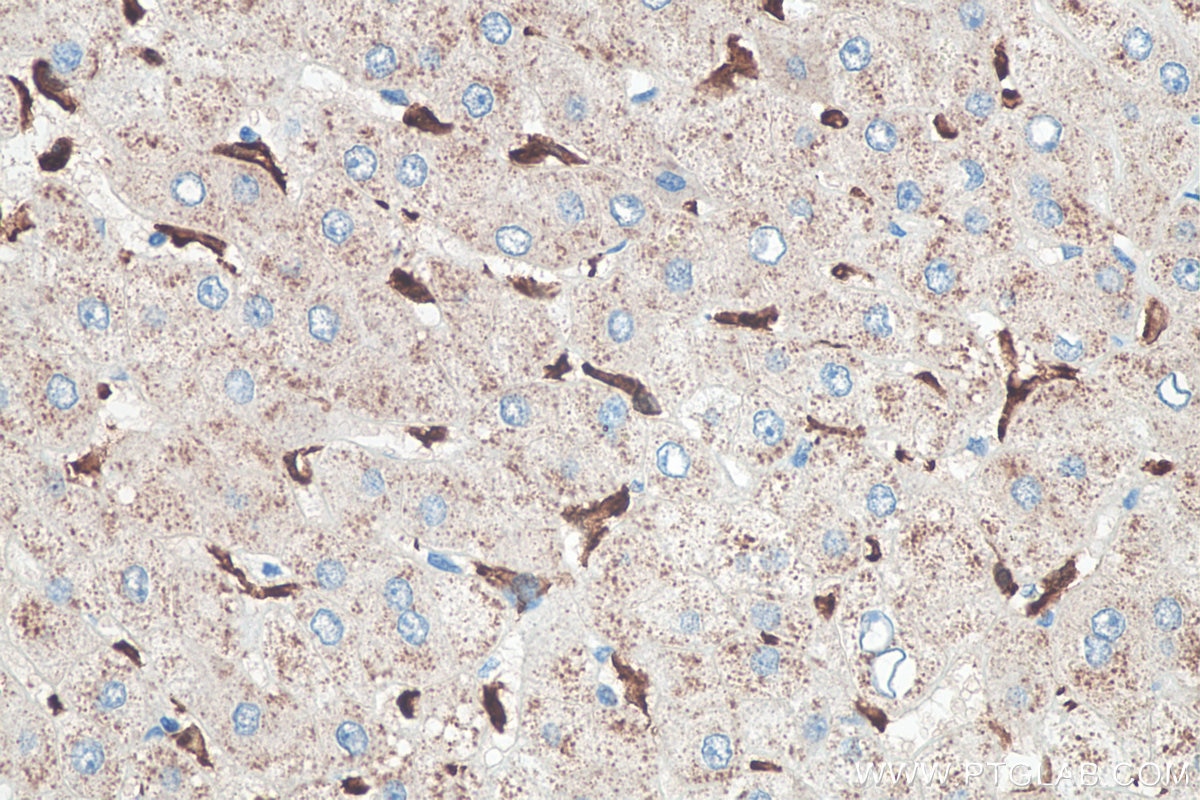Immunohistochemistry (IHC) staining of human liver tissue using IBA1 Polyclonal antibody (10904-1-AP)