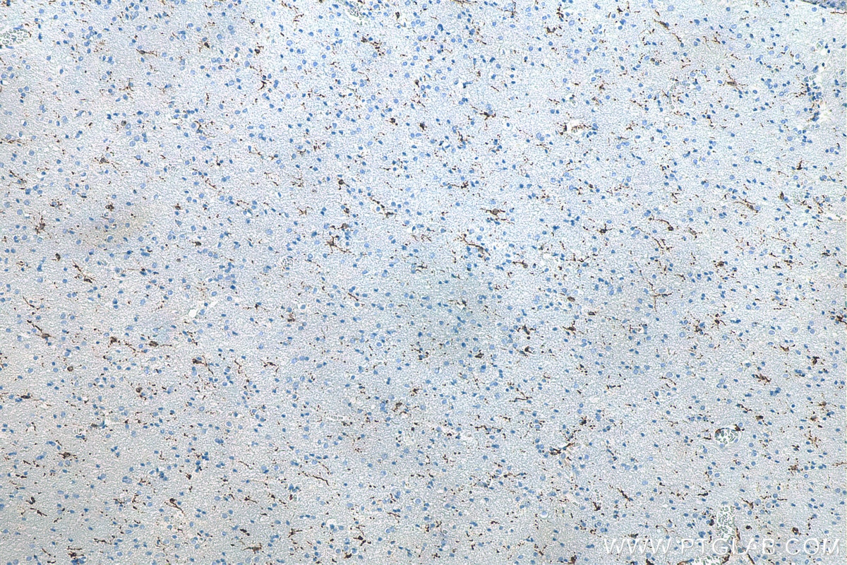 Immunohistochemistry (IHC) staining of human brain tissue using IBA1 Polyclonal antibody (10904-1-AP)