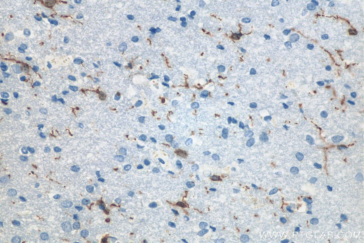 Immunohistochemistry (IHC) staining of human brain tissue using IBA1 Polyclonal antibody (10904-1-AP)