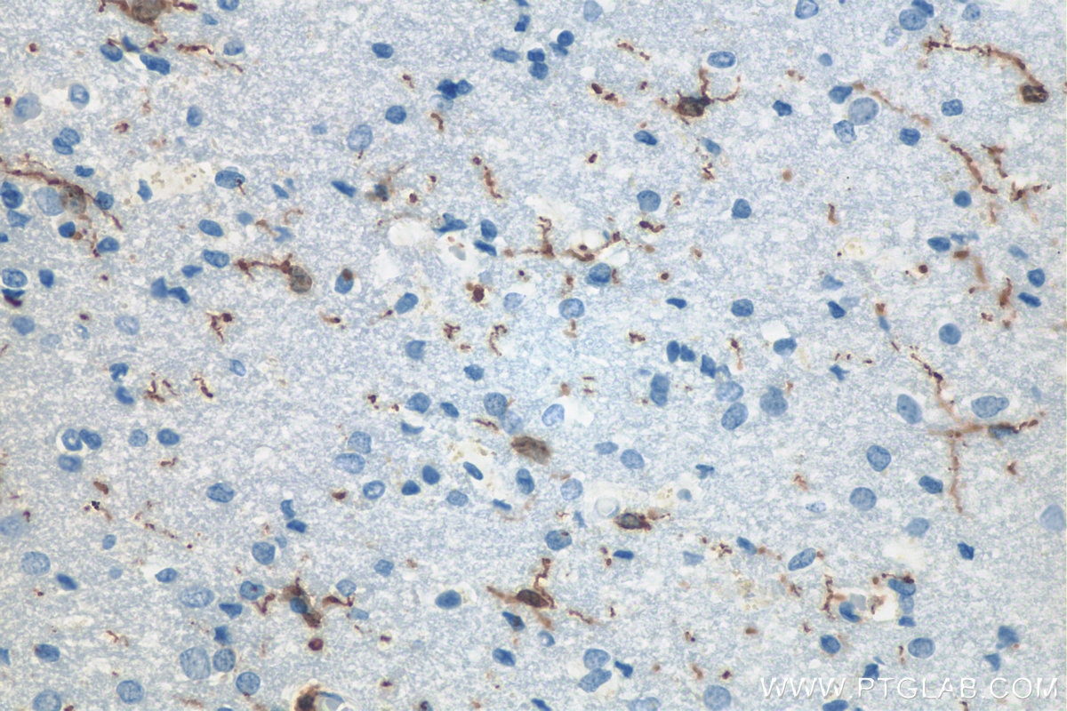 IHC staining of human brain using 10904-1-AP