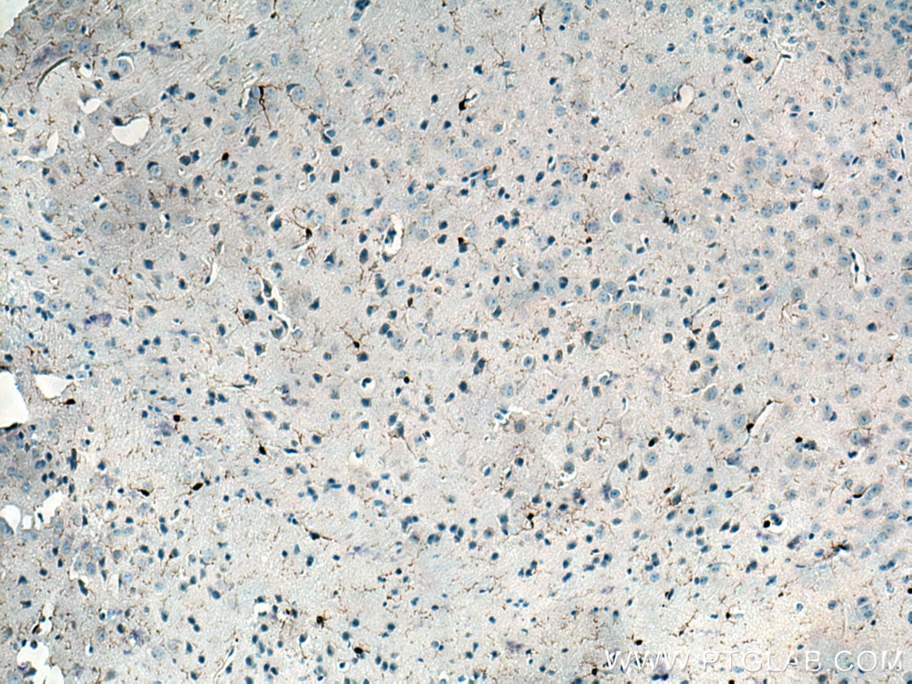 Immunohistochemistry (IHC) staining of mouse brain tissue using IBA1 Polyclonal antibody (26177-1-AP)