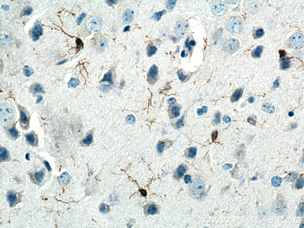 Immunohistochemistry (IHC) staining of mouse brain tissue using IBA1 Polyclonal antibody (26177-1-AP)