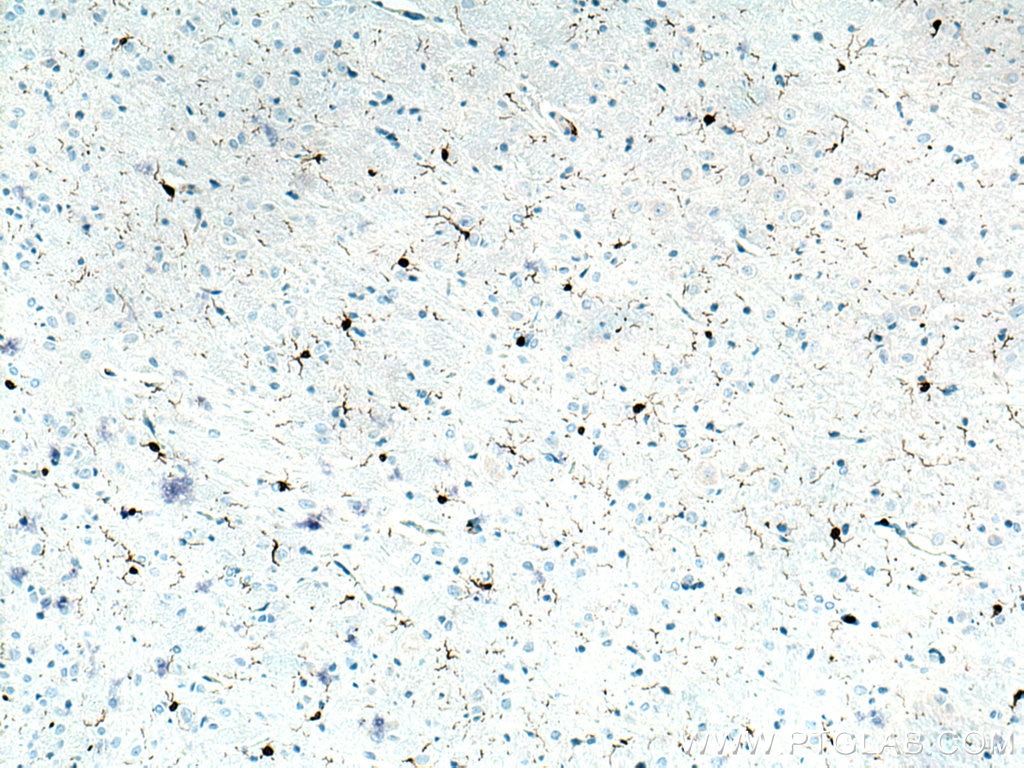 Immunohistochemistry (IHC) staining of rat brain tissue using IBA1 Polyclonal antibody (26177-1-AP)