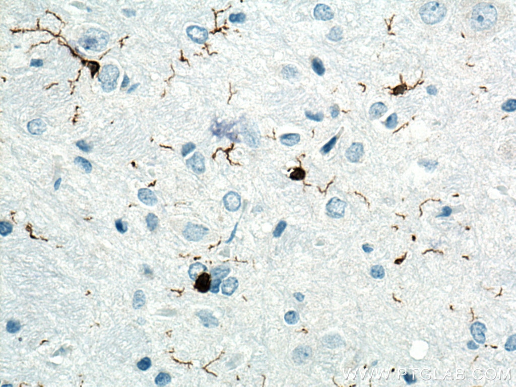 Immunohistochemistry (IHC) staining of rat brain tissue using IBA1 Polyclonal antibody (26177-1-AP)