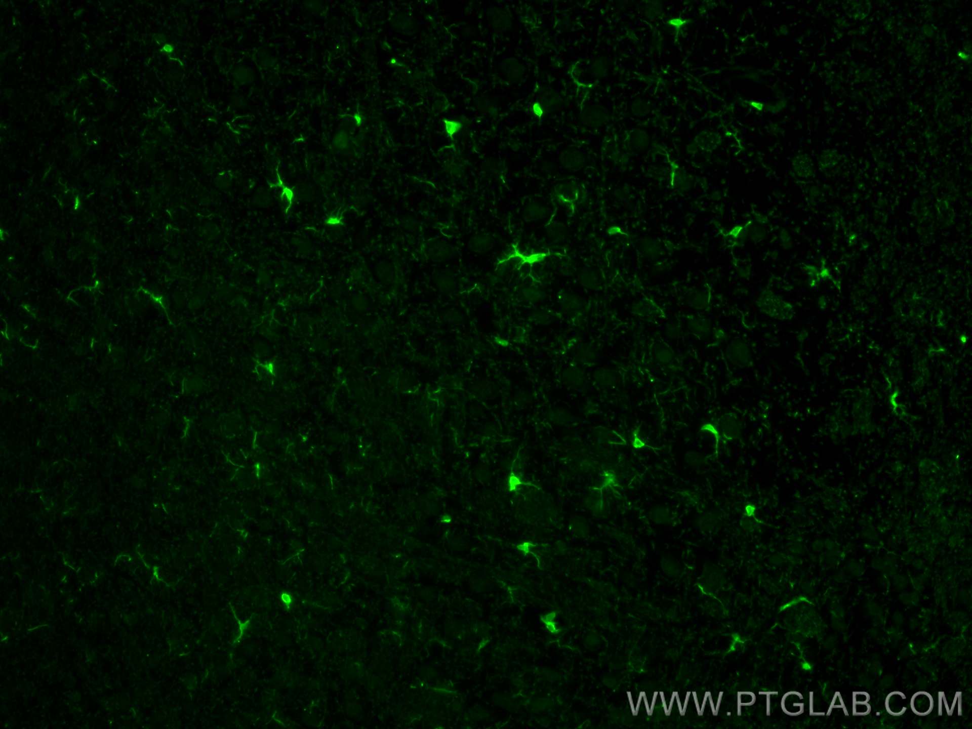 Immunofluorescence (IF) / fluorescent staining of rat brain tissue using IBA1 Polyclonal antibody (30523-1-AP)