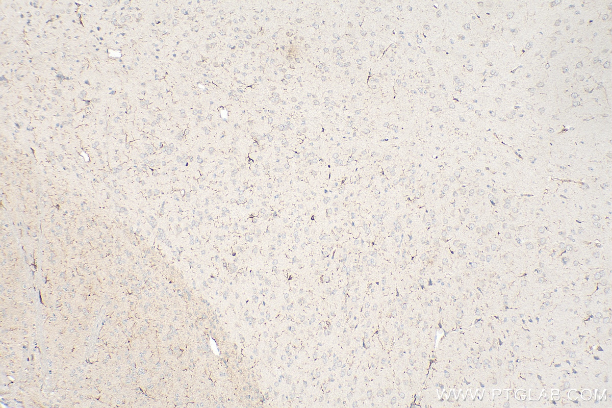 Immunohistochemistry (IHC) staining of mouse brain tissue using IBA1 Polyclonal antibody (30523-1-AP)