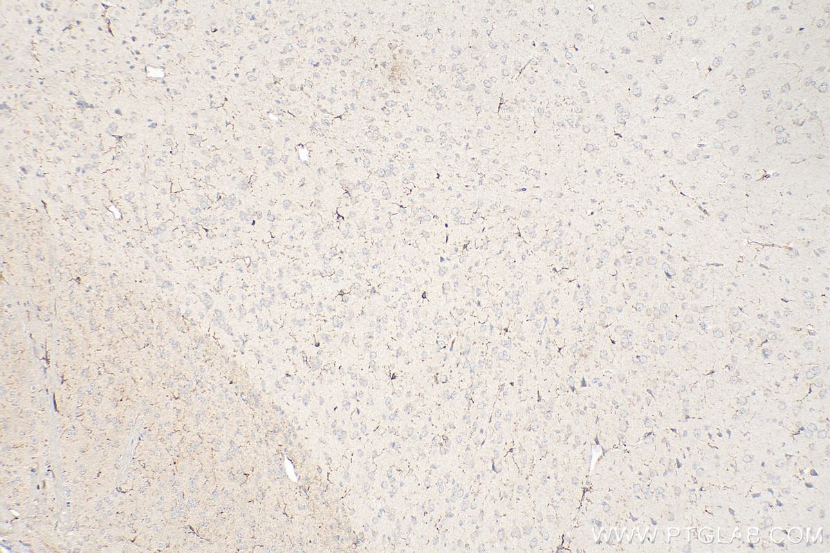 Immunohistochemistry (IHC) staining of mouse brain tissue using IBA1 Polyclonal antibody (30523-1-AP)