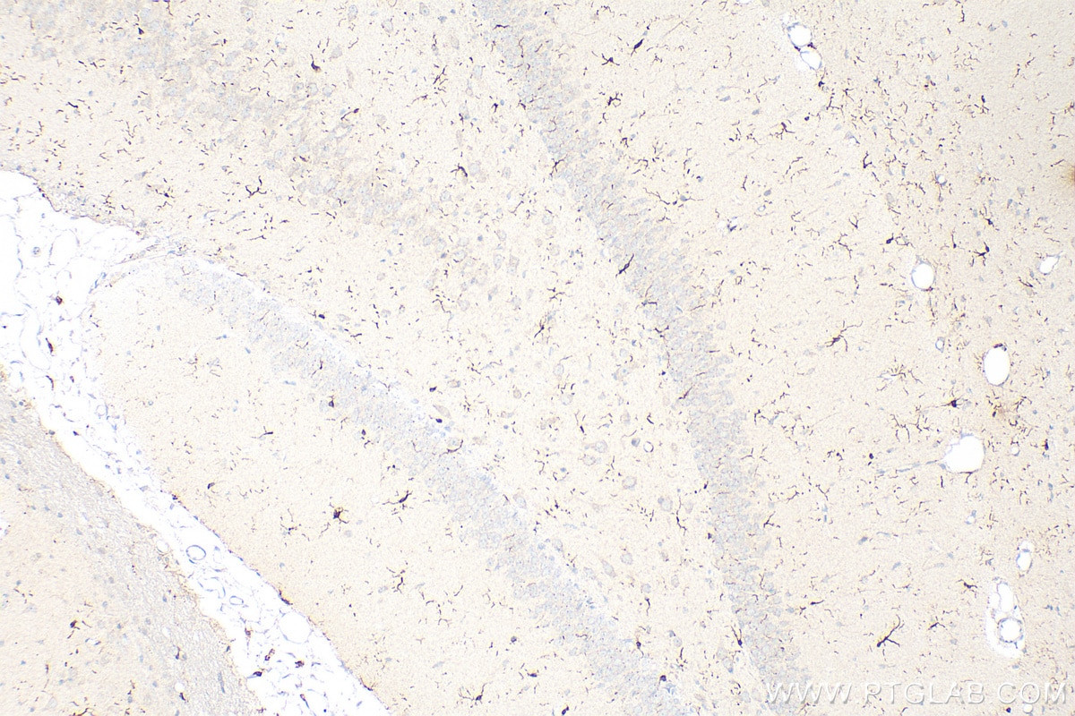 Immunohistochemistry (IHC) staining of rat brain tissue using IBA1 Polyclonal antibody (30523-1-AP)