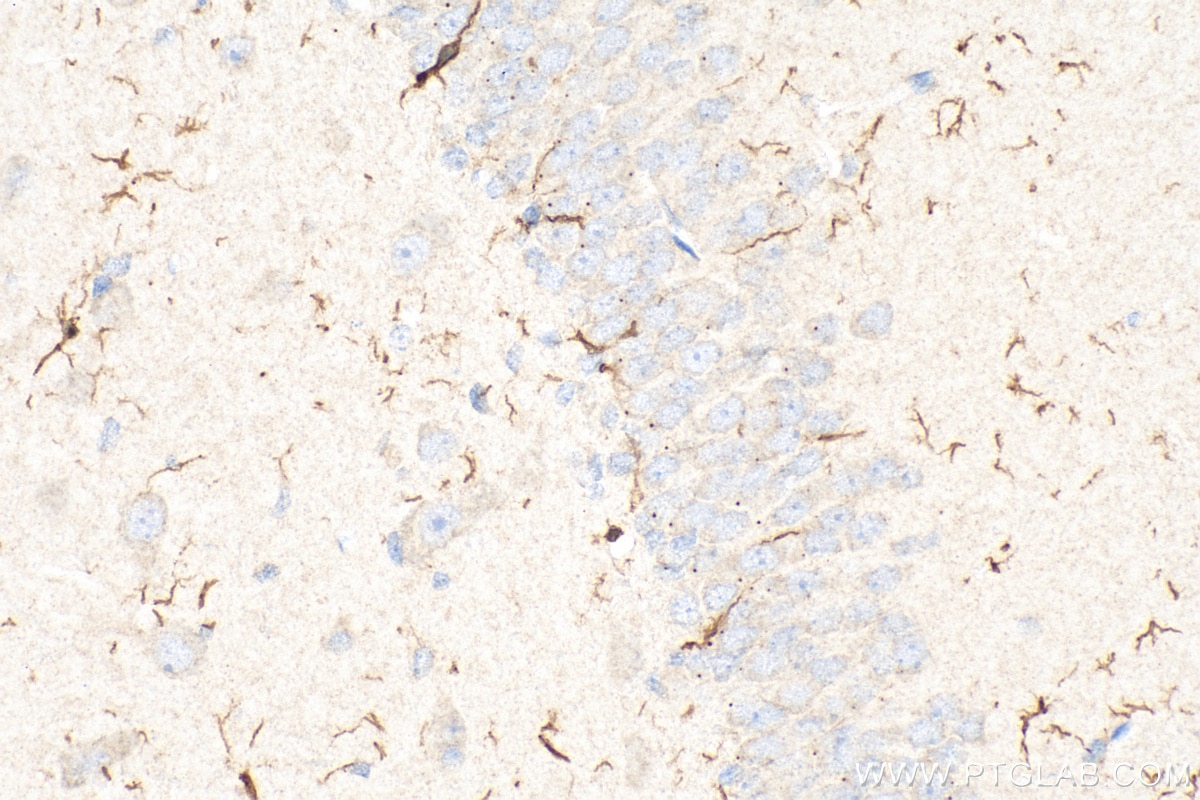 IHC staining of rat brain using 30523-1-AP