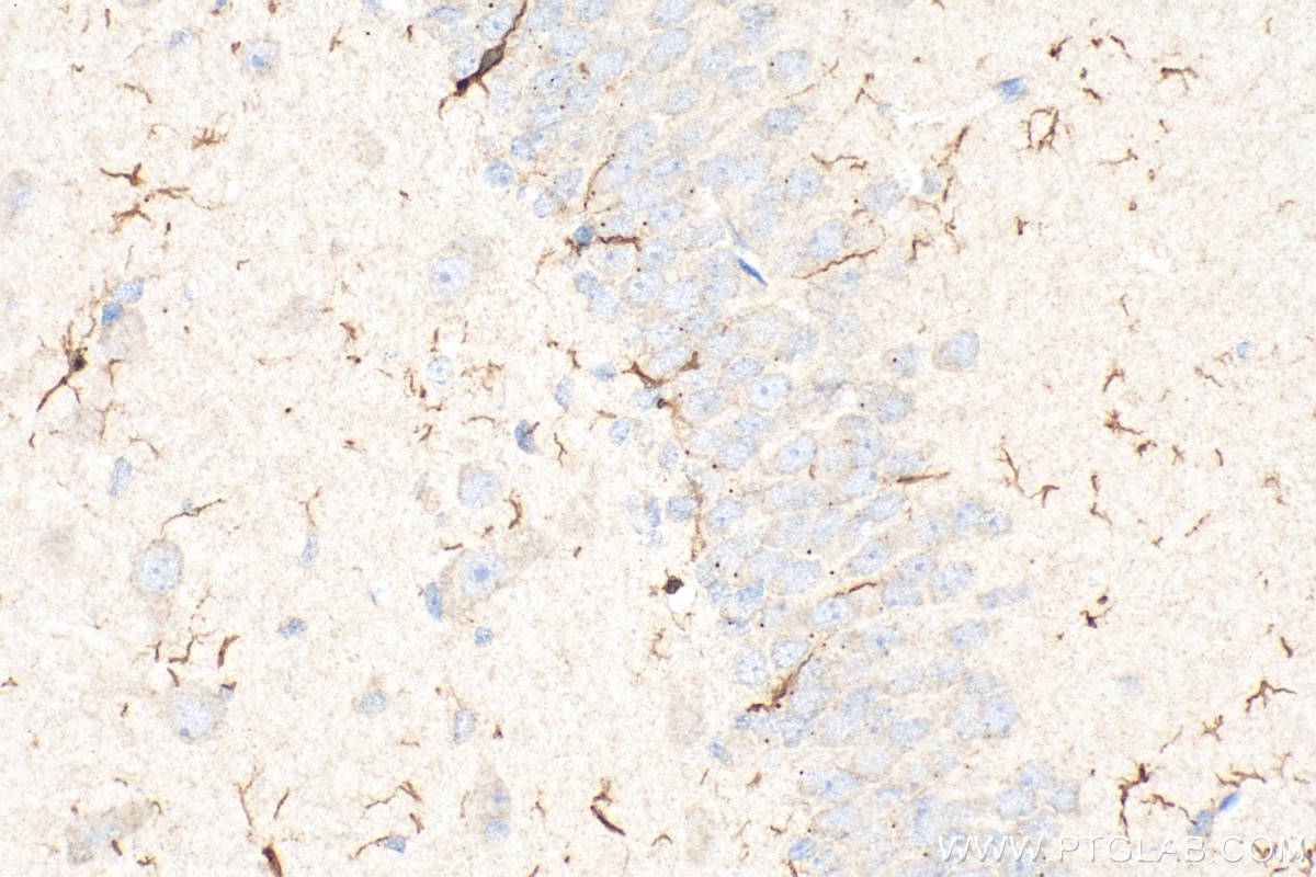 Immunohistochemistry (IHC) staining of rat brain tissue using IBA1 Polyclonal antibody (30523-1-AP)