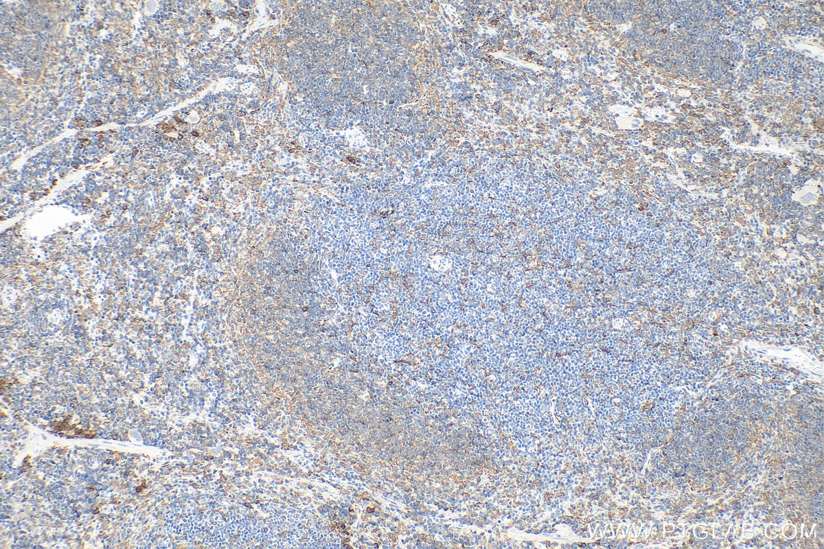 Immunohistochemistry (IHC) staining of mouse spleen tissue using IBA1 Polyclonal antibody (30523-1-AP)