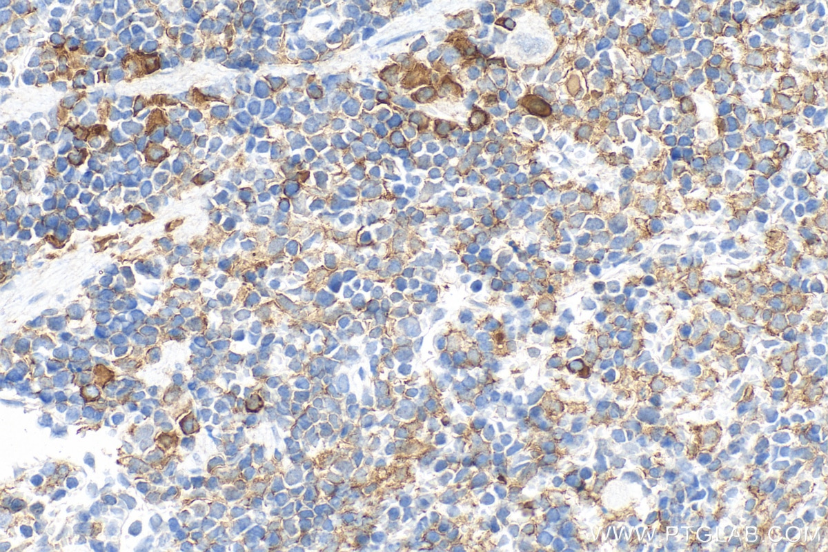 Immunohistochemistry (IHC) staining of mouse spleen tissue using IBA1 Polyclonal antibody (30523-1-AP)