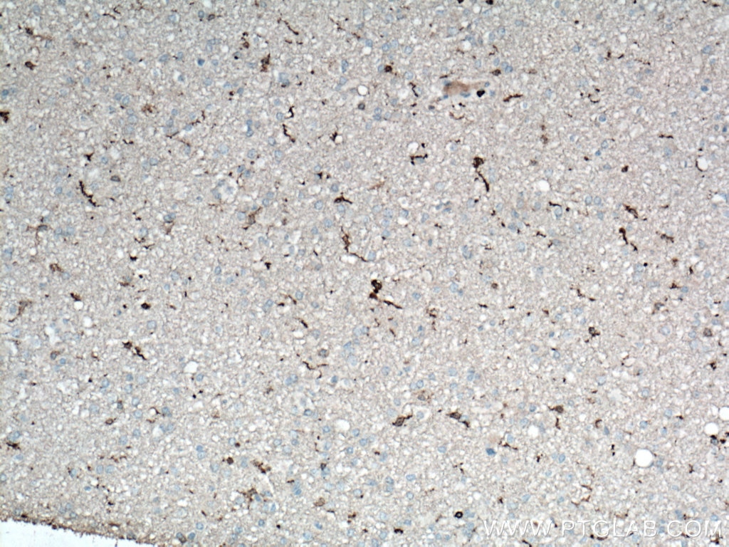 Immunohistochemistry (IHC) staining of human brain tissue using IBA1 Monoclonal antibody (66827-1-Ig)