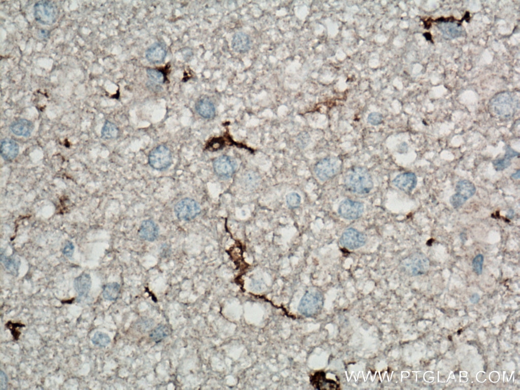 Immunohistochemistry (IHC) staining of human brain tissue using IBA1 Monoclonal antibody (66827-1-Ig)
