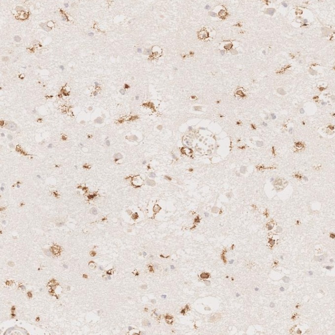 IHC staining of human brain using 66827-1-Ig Immunohistochemistry (IHC) staining of human brain tissue using human IBA1 Monoclonal antibody (66827-1-Ig)