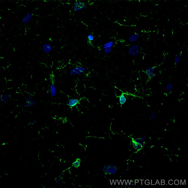 Immunofluorescence (IF) / fluorescent staining of rat brain tissue using IBA1 Recombinant antibody (81728-1-RR)