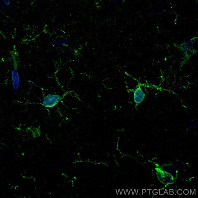 Immunofluorescence (IF) / fluorescent staining of rat brain tissue using IBA1 Recombinant antibody (81728-1-RR)
