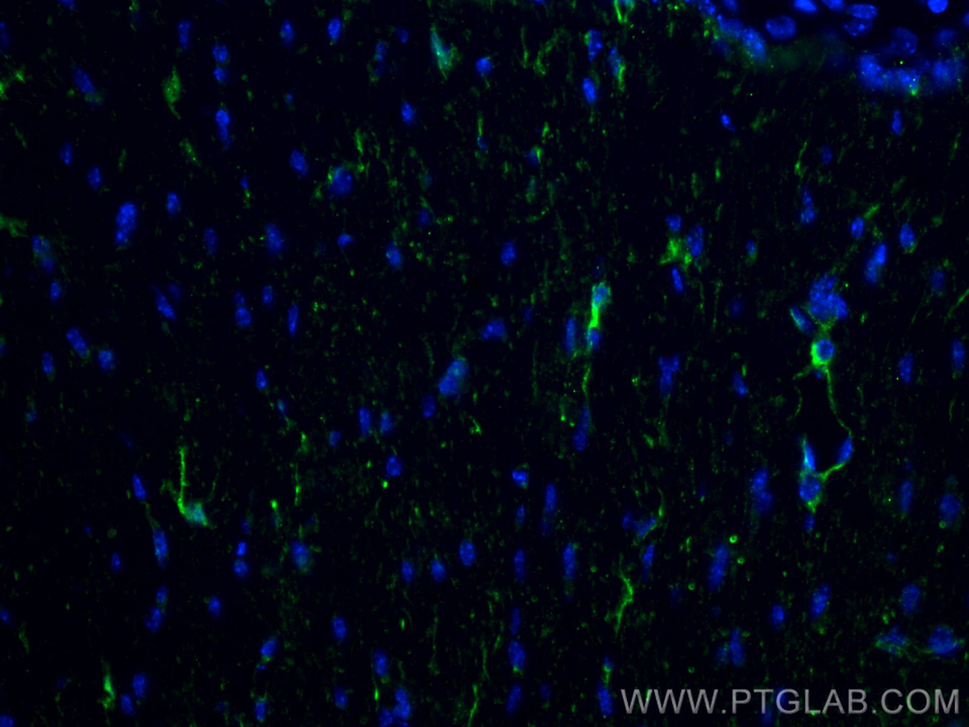 Immunofluorescence (IF) / fluorescent staining of mouse brain tissue using IBA1 Recombinant antibody (81728-1-RR)