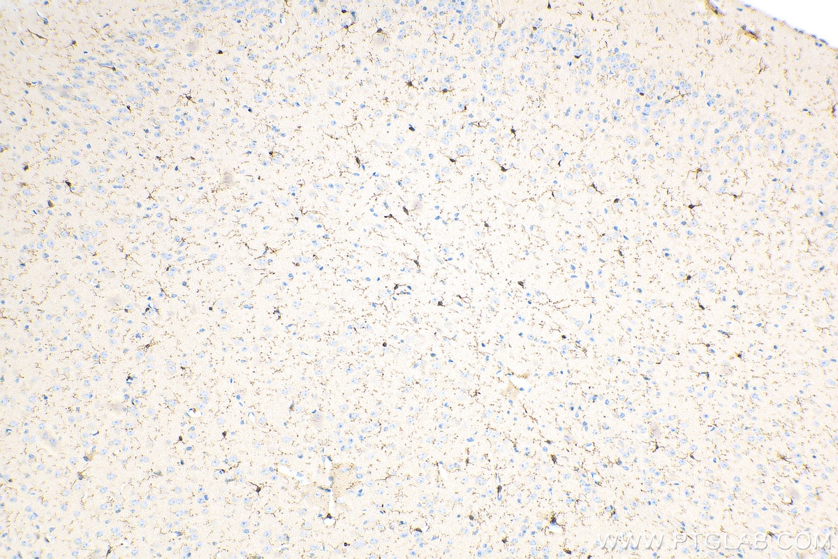 Immunohistochemistry (IHC) staining of mouse brain tissue using IBA1 Recombinant antibody (81728-1-RR)