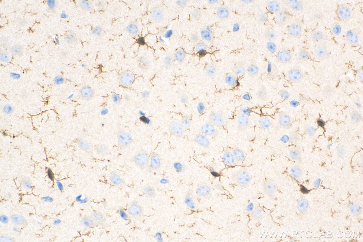 Immunohistochemistry (IHC) staining of mouse brain tissue using IBA1 Recombinant antibody (81728-1-RR)