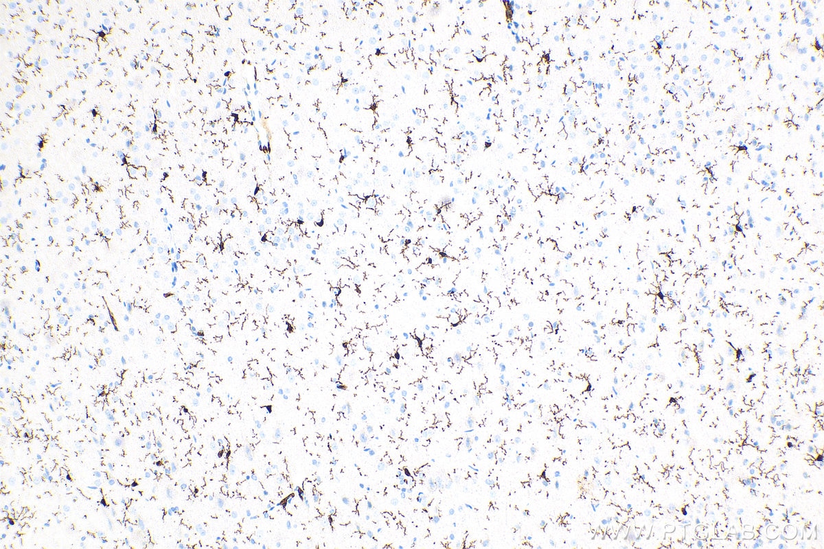 Immunohistochemistry (IHC) staining of rat brain tissue using IBA1 Recombinant antibody (81728-1-RR)