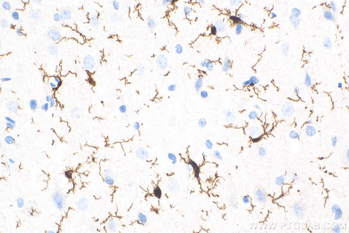 Immunohistochemistry (IHC) staining of rat brain tissue using IBA1 Recombinant antibody (81728-1-RR)