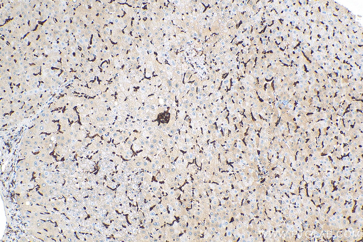 Immunohistochemistry (IHC) staining of human liver tissue using IBA1 Recombinant antibody (81728-1-RR)