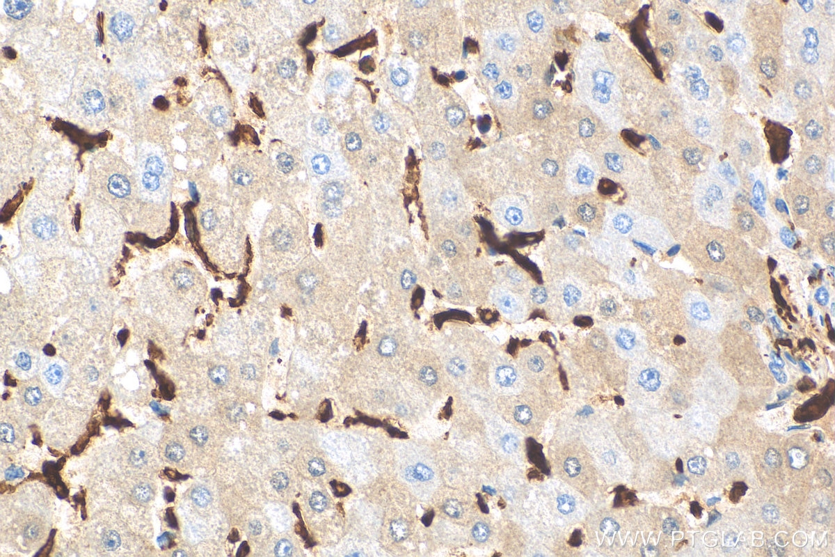 Immunohistochemistry (IHC) staining of human liver tissue using IBA1 Recombinant antibody (81728-1-RR)