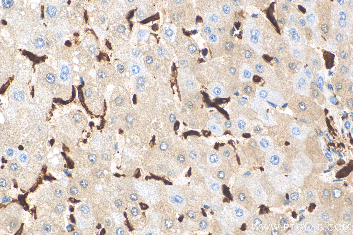 IHC staining of human liver using 81728-1-RR