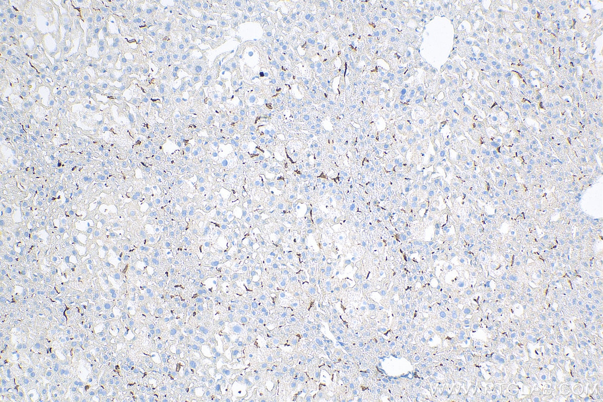 Immunohistochemistry (IHC) staining of mouse liver tissue using IBA1 Recombinant antibody (81728-1-RR)