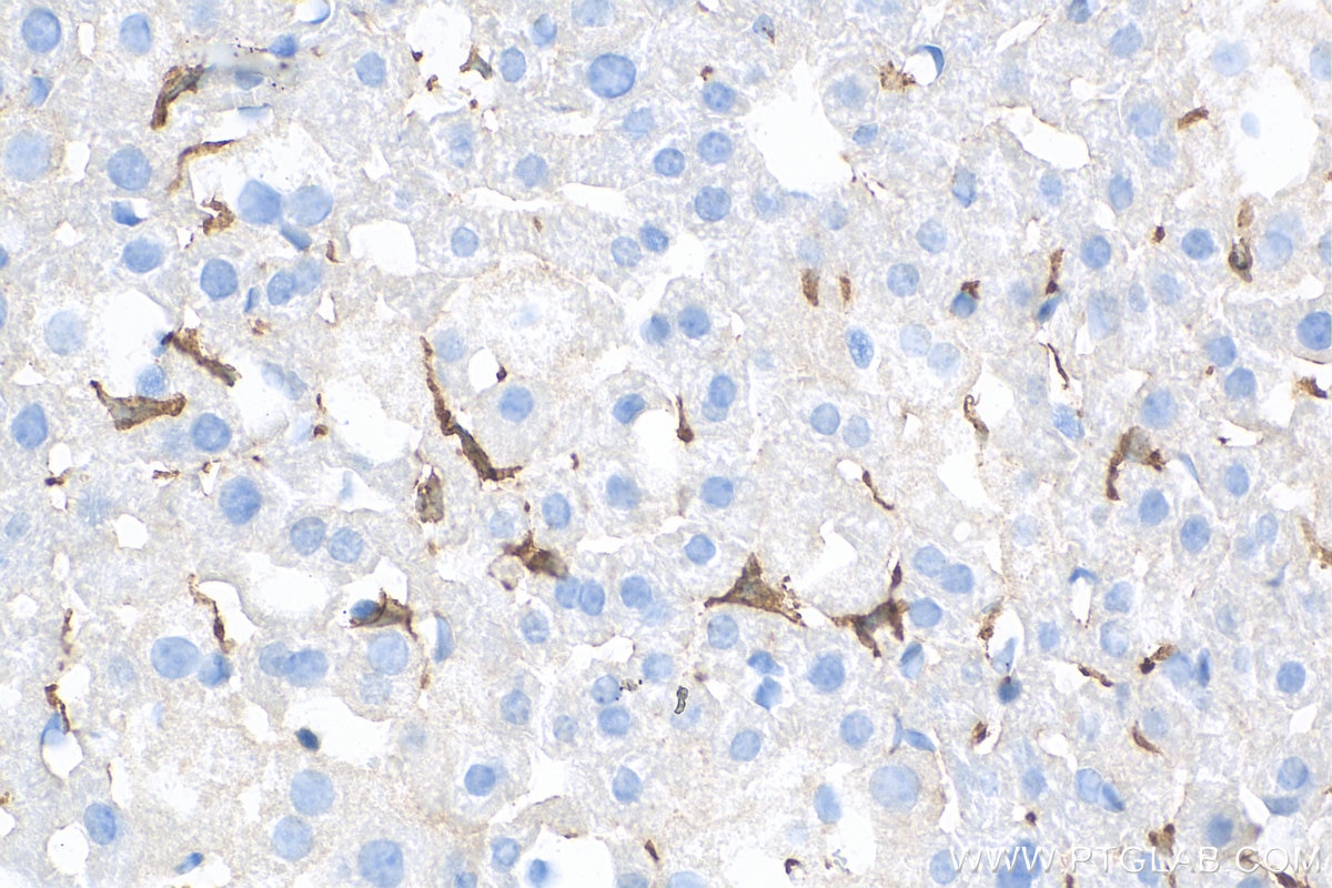 Immunohistochemistry (IHC) staining of mouse liver tissue using IBA1 Recombinant antibody (81728-1-RR)