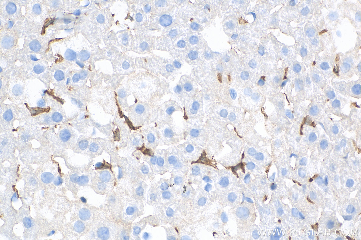 IHC staining of mouse liver using 81728-1-RR