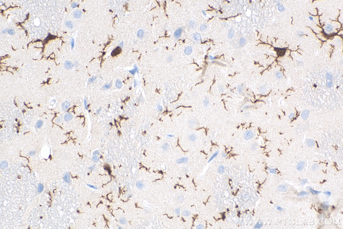 IHC staining of rat brain using 81728-1-RR