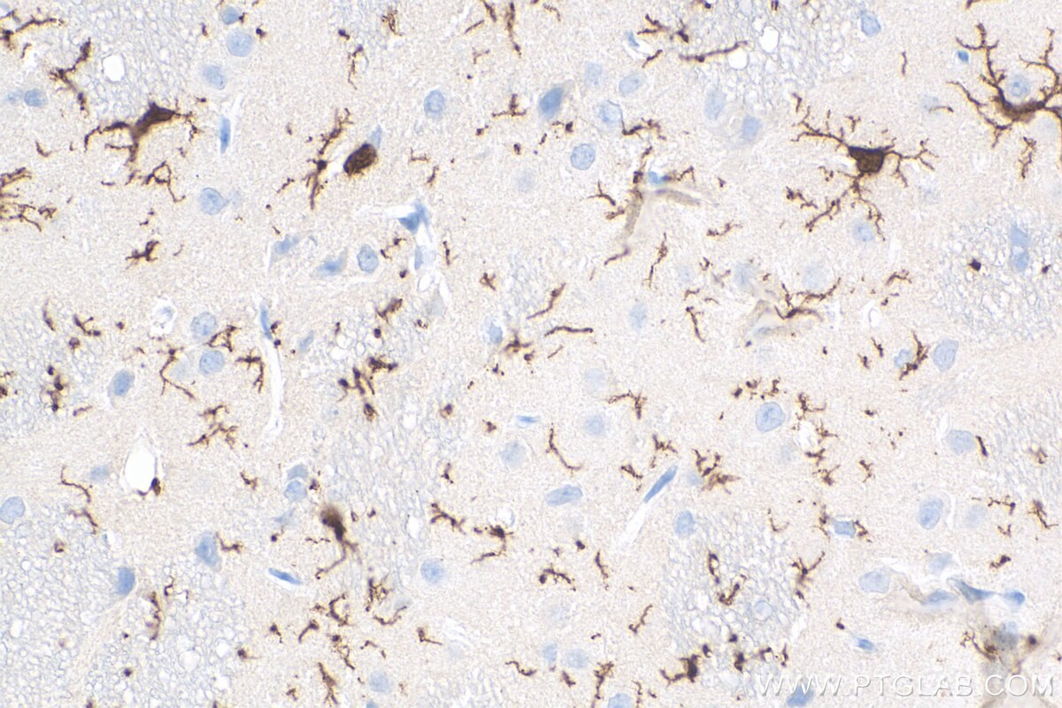 Immunohistochemistry (IHC) staining of rat brain tissue using IBA1 Recombinant antibody (81728-1-RR)