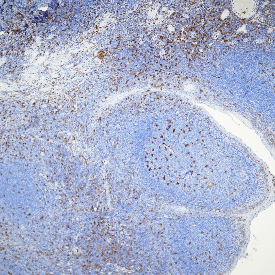 Immunohistochemistry (IHC) staining of human tonsil tissue using IBA1 Recombinant monoclonal antibody (81728-1-RR)