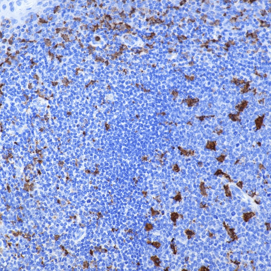Immunohistochemistry (IHC) staining of human tonsil tissue using IBA1 Recombinant monoclonal antibody (81728-1-RR)