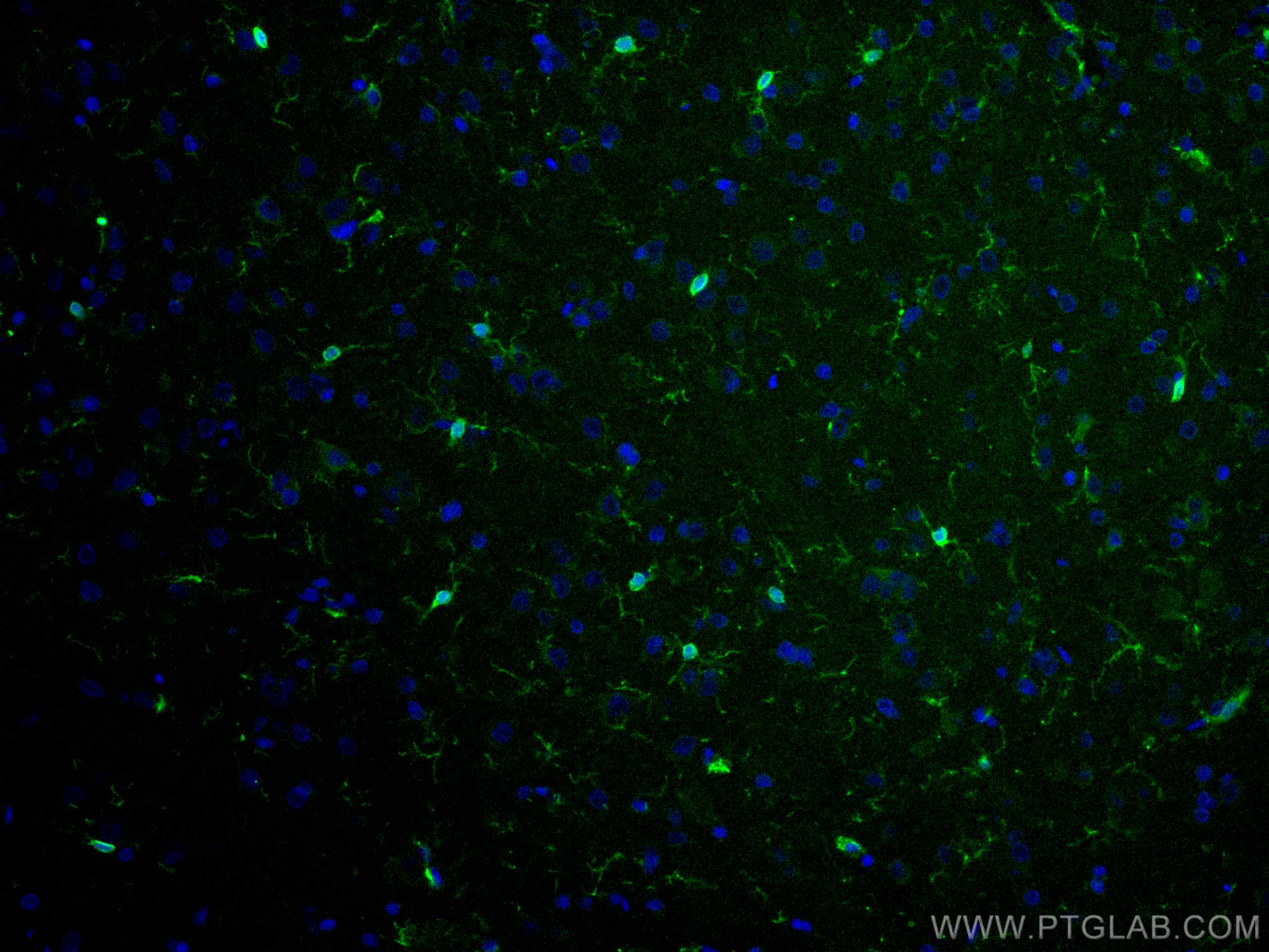 IF Staining of rat brain using CL488-10904