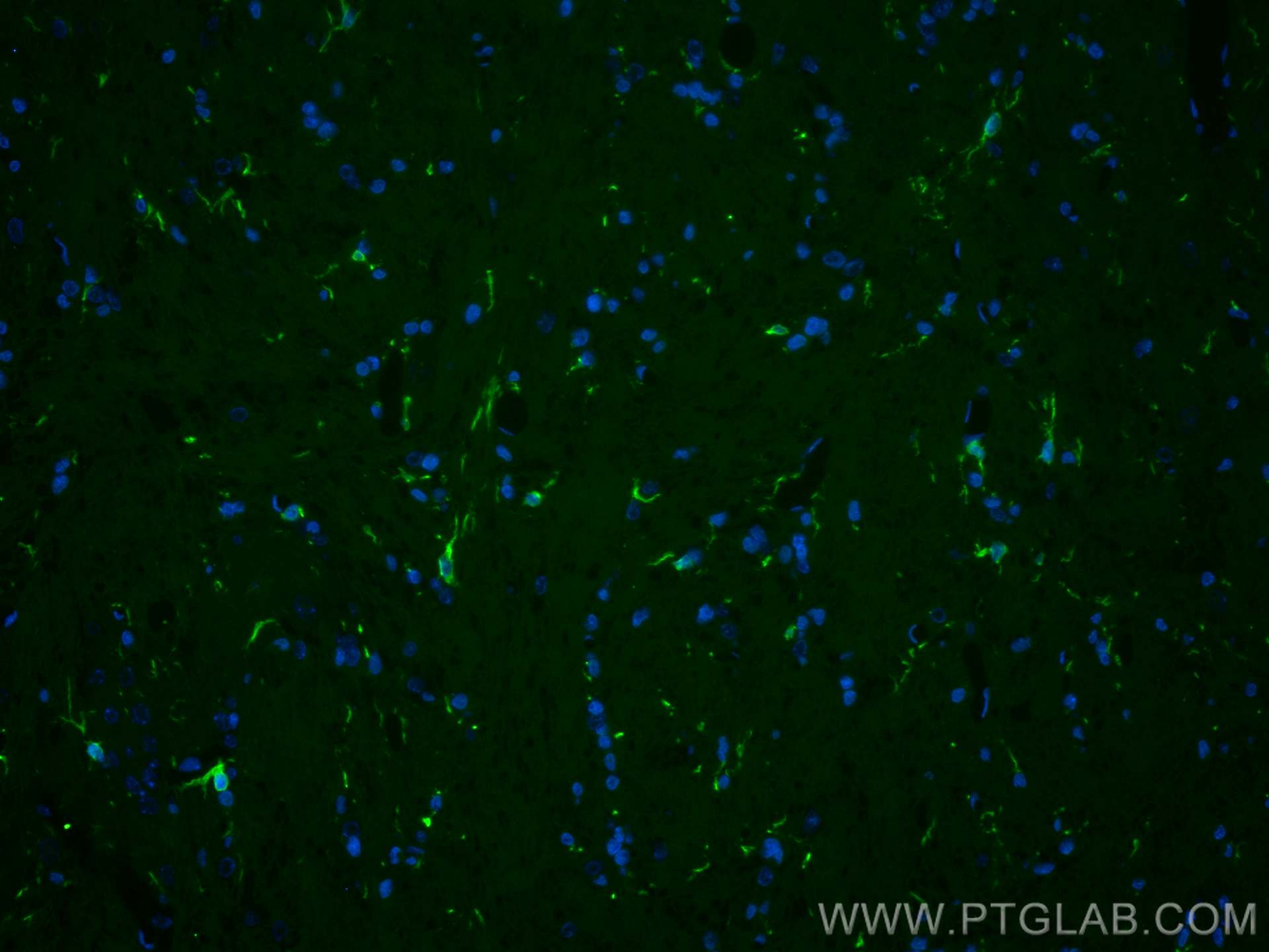 Immunofluorescence (IF) / fluorescent staining of rat brain tissue using CoraLite® Plus 488-conjugated IBA1 Polyclonal anti (CL488-10904)